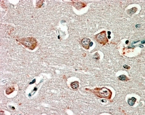 IHC testing of FFPE human cortex with GABRB3 antibody at 2.5ug/ml. HIER: steamed with pH6 citrate bu
