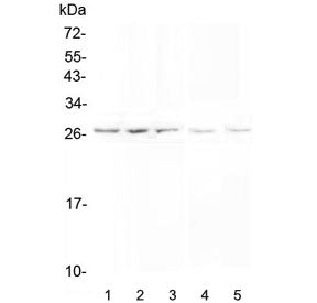 VAPB Antibody