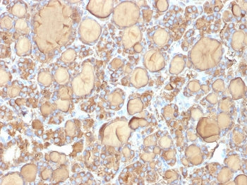 IHC: Formalin-fixed, paraffin-embedded human thyroid gland stained with recombinant TG antibody (clo