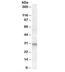 Western blot testing of human heart lysate with FHL2 antibody at 1ug/ml. Predicted molecular weight: