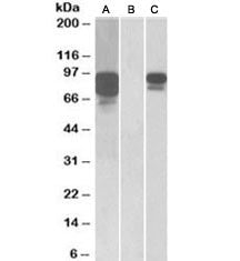 Western blot of HEK293 lysate overexpressing human PCSK9 with MYC tag probed with PCSK9 antibody [1u