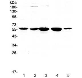Western blot testing of human 1) placenta, 2) HeLa, 3) 22RV1, 4) SKOV and 5) A549 lysate with ETV6 a