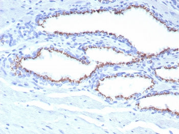 IHC staining of FFPE human prostate tissue with SLC45A3 antibody (clone SLC45A3/7653). HIER: boil ti