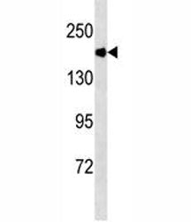 ACE antibody western blot analysis in mouse kidney tissue lysate. Expected molecular weight 140-170 