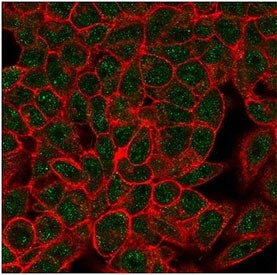 Immunofluorescent staining of PFA-fixed human HeLa cells using Myf-4 antibody (green, clone PCRP-MYOG-1C5) and phalloidin (red).