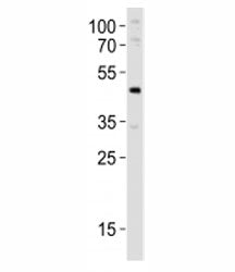 Pdx1 Antibody
