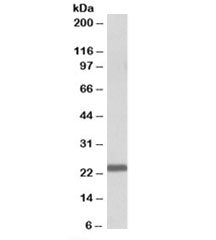 Western blot testing of human bone marrow lysate with IL15 antibody at 1ug/ml. Predicted molecular w