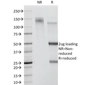 SDS-PAGE Analysis of Purified, BSA-Free CDw78 Antibody (clone DF1588). Confirmation of Integrity and