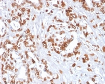 TCF4 Antibody
