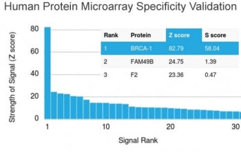 Analysis of HuProt(TM) microarray containing more than 19,000 full-length human proteins using BRCA1