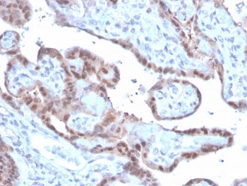 IHC staining of FFPE human placenta with SOD1 antibody. HIER: boil tissue sections in pH 9 10mM Tris