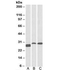 Western blot testing of A) human tonsil, B) rat spleen, C) pig spleen lysates with APRIL antibody at