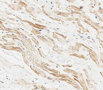 LC3A Antibody / MAP1LC3A