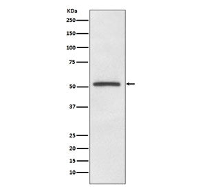 Western blot testing of human A375 cell lysate with MITF antibody. Predicted molecular weight: 55-60