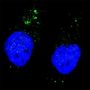 Fluorescent image of Chloroquine treated U251 cells stained with phospho-ULK1 antibody at 1:200. Imm