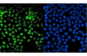 Immunofluorescent staining of FFPE human A431 cells with PTF1A antibody (green) and DAPI nuclear sta