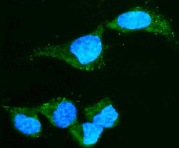 CRYAA Antibody / Alpha A Crystallin