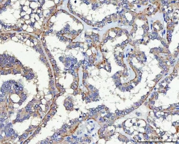 HP59 Antibody / Sialin / SLC17A5