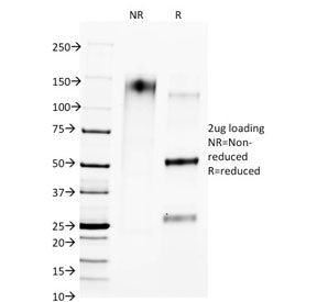 SDS-PAGE analysis of purified, BSA-free CTLA4 antibody (clone L4P2F5.F10) as confirmation of integri