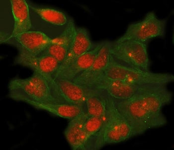 TSHZ1 Antibody / Teashirt homolog 1