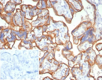 CD147 / Emmprin / Basigin Antibody