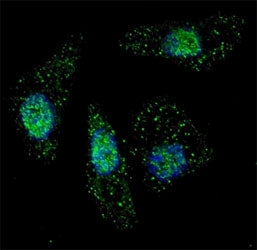 Fluorescent image of Chloroquine treated U251 cells stained with ATG7 antibody at 1:200. Immunoreact