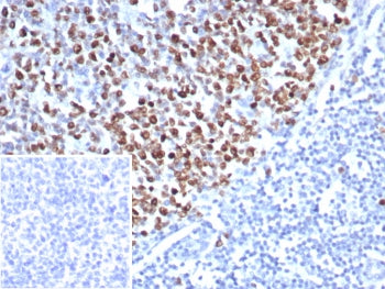 IHC staining of FFPE human tonsil tissue with recombinant TOP2A antibody (clone rTOP2A/8339). Inset: