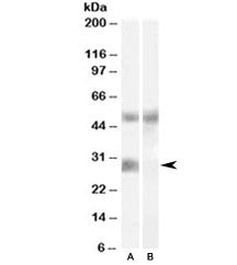 Western blot testing of human breast cancer lysate with IGFBP3 antibody at 0.02ug/ml with [B] and wi