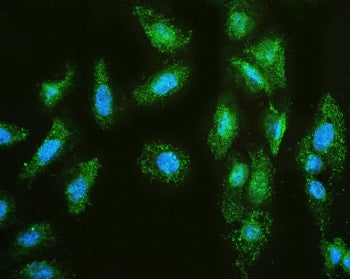 Immunofluorescent staining of FFPE human U-2 OS cells with MMP1 antibody (green) and DAPI (blue). HI