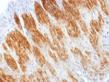 Calponin 1 Antibody