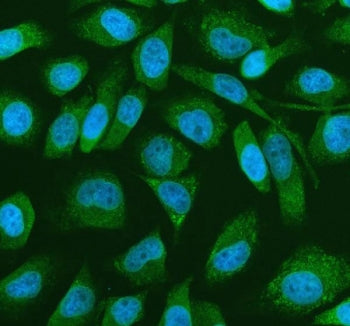 Immunofluorescent staining of FFPE human HeLa cells with PRMT4 antibody (green) and DAPI nuclear sta