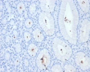 IHC staining of FFPE Helicobacter pylori-infected human stomach tissue with H pylori antibody (clone HPYL/7228). HIER: boil tissue sections in pH 9 10mM Tris with 1mM EDTA for 20 min and allow to cool before testing.