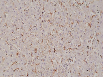 Recombinant Caveolin-1 Antibody