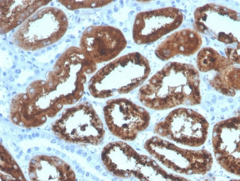 Retinol Binding Protein 4 Antibody / RBP4