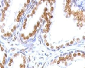 Androgen Receptor Antibody