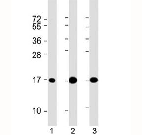 Western blot testing of 1) human brain, 2) mouse brain and 3) rat brain lysate with LC3 antibody at 
