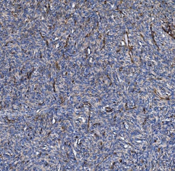 Collagen IV Antibody / COL4A3