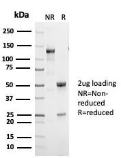 SDS-PAGE analysis of purified, BSA-free p53 antibody (clone TP53/7002R) as confirmation of integrity