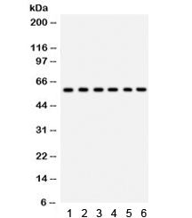Western blot testing of 1) rat thymus, 2) rat lung, 3) HeLa, 4) 22RV1, 5) A431 and 6) mouse HEPA lys