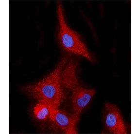 Immunofluorescent staining of FFPE human A549 cells with EHD2 antibody (red) and DAPI nuclear stain 