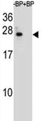 BCL-2 Antibody