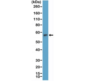 Western blot testing of human Jurkat cell lysate with recombinant TdT antibody at 1:2000 dilution. P