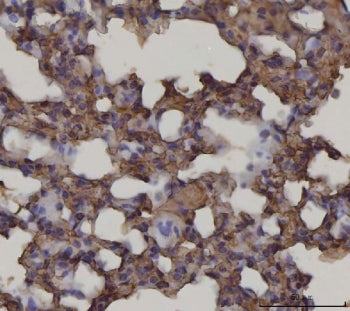 AGER Antibody / RAGE