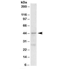 Western blot testing of MCF7 lysate with PRMT6 antibody at 0.5ug/ml. Predicted molecular weight: ~42