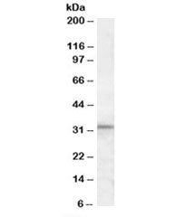 Western blot testing of human testis lysate with HAX1 antibody at 1ug/ml. Predicted molecular weight