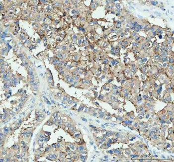 IHC staining of FFPE human liver tissue with DDT antibody. HIER: boil tissue sections in pH8 EDTA fo
