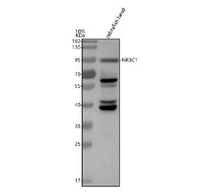 Western blot analysis of Glucocorticoid receptor protein using Zebrafish Glucocorticoid receptor ant