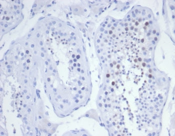 KIF2C Antibody / MCAK