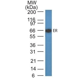 Estrogen Receptor alpha Antibody