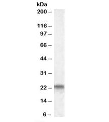 Western blot testing of human heart lysate with CAV3 antibody at 0.3ug/ml. Predicted molecular weigh